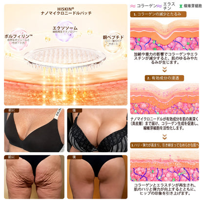 HISKIN®🏆 バストケア ナノマイクロニードルパッチ ふっくらボリューム感・ハリ・弾力をサポート ボルフィリン × エクソソーム × 銅ペプチド配合 先進の美容成分デリバリーテクノロジー採用